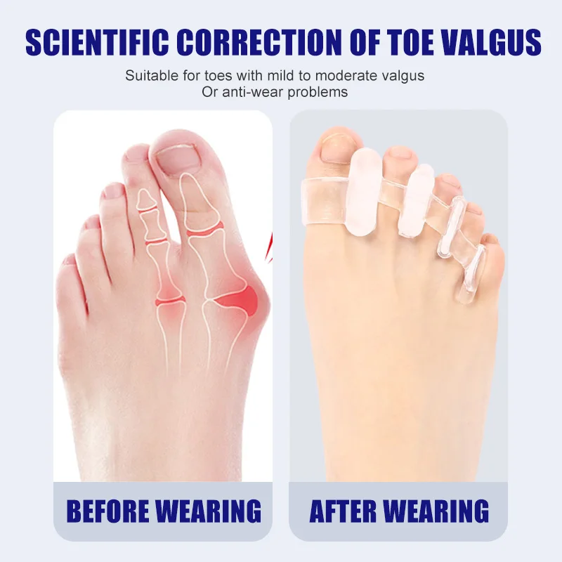 1 Pair Silicone Toe Separator  - Toe Separator Silicon avaliação e preço