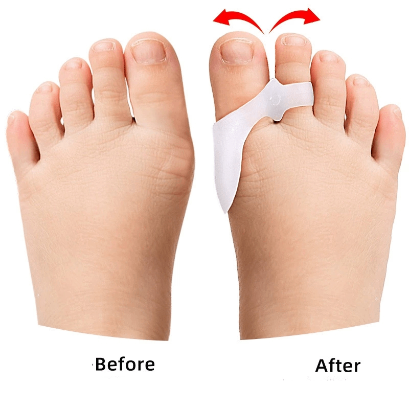 1/2/3Pairs Children's Gel Toe  - Toe Separator Silicon avaliação e preço