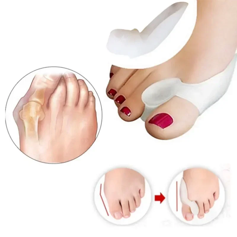 2PCS Silicone Gel Thumb Correc - Toe Separator Silicon avaliação e preço