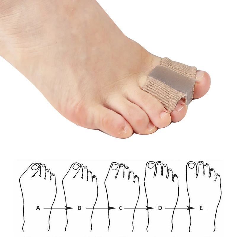 New Toe Separator Hallux Valgu - Toe Separator Silicon avaliação e preço