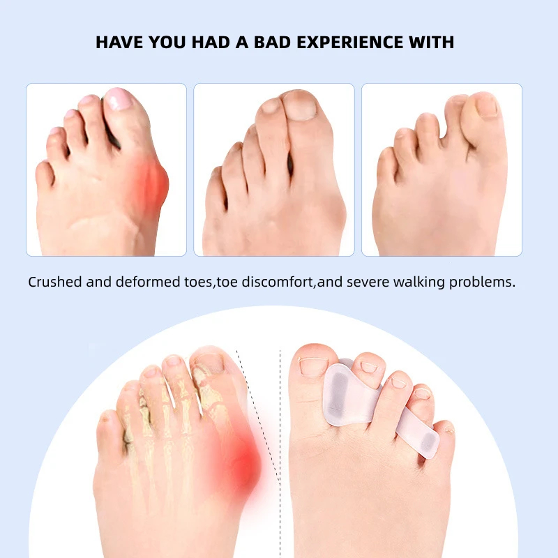 1/2/5Pairs Hallux Valgus Appli - Toe Separator Silicon avaliação e preço